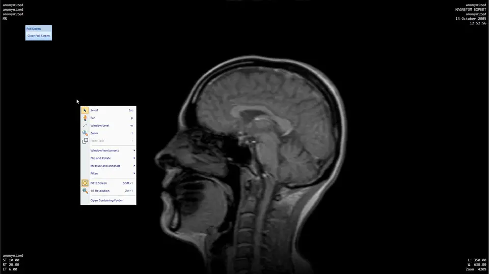 MicroDicom DICOM Viewer