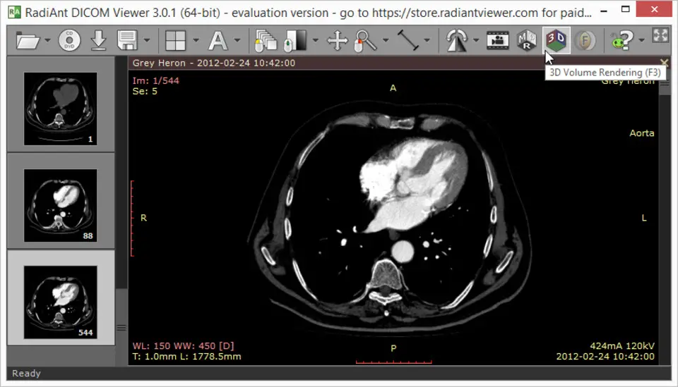 RadiAnt Dicom Viewer